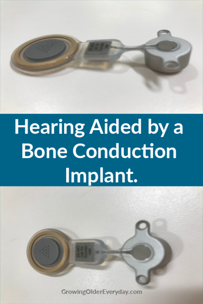 hearing bone conduction implant
