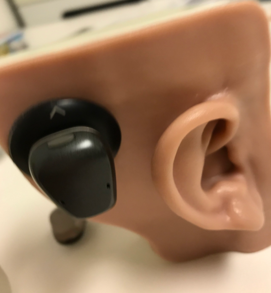 hearing bone conduction implant